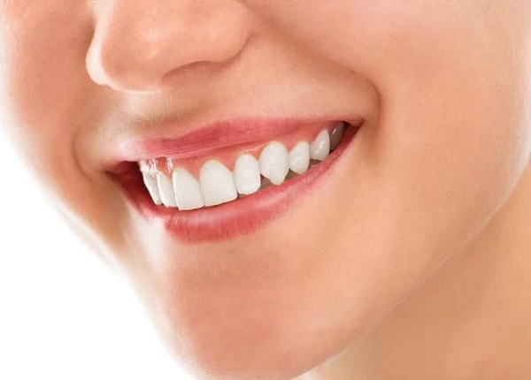 Một số biện pháp tự nhiên giúp làm trắng răng