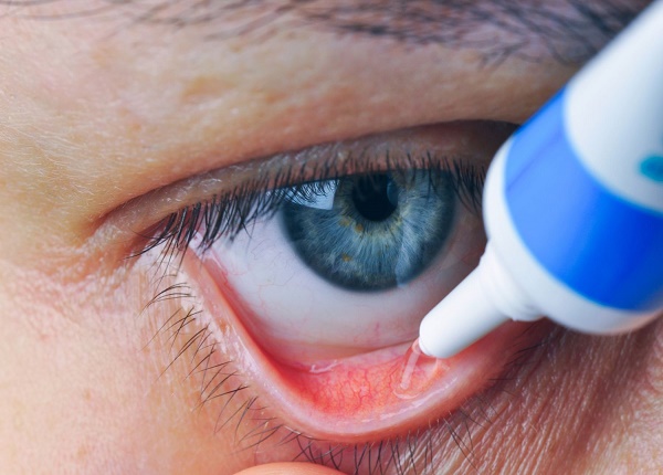 Dùng thuốc tra mắt phải đúng cách để đạt được hiệu quả cao trong điều trị bệnh